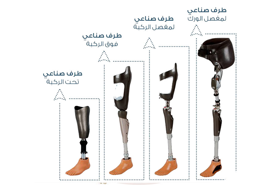 مكونات-الاطراف-الصناعية-01